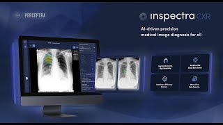 Inspectra CXR AIPowered Chest XRay Analysis  Revolutionizing Medical Diagnostics [upl. by Enilaf]