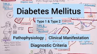 Diabetes Mellitus Type 1 amp Type 2 [upl. by Butcher]