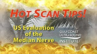 Hot Tips  Ultrasound Evaluation of the Median Nerve [upl. by Artkele]