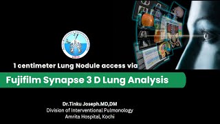 Fujifilm Synapse 3D Lung Analysis guided sampling of a 1 cmsized Lung nodule [upl. by Helli911]