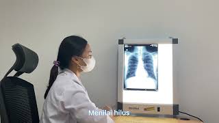 Tugas Akhir CSL Cardiorespiratory and XRay Examination [upl. by Oralee233]