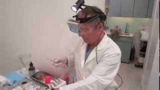 Facial Sclerotherapy Performed By Dr Luis Navarro [upl. by Apthorp]