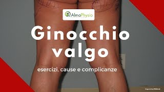 ginocchio valgo esercizi cause e complicanze SPIEGAZIONE COMPLETA [upl. by Odlavu]