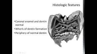 Developmental disturbance of Dentin [upl. by Ecirtnuahs]