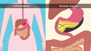 How does obesity cause cancer [upl. by Rann]