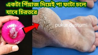 এক রাতে পা ফাটার থেকে মুক্তি পরো ঘরোয়া টিপসcarcked heels treatmentkitchen tipes amphakes [upl. by Anaert]