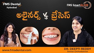 FMS Dental Orthodontist Dr Deepti Reddy About Aligners vs Braces Treatment  sumantvtelugulive [upl. by Attenra]