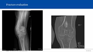 Introduction to Musculoskeletal Radiology [upl. by Eded]