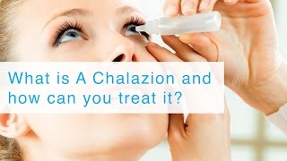 What is A Chalazion and how can you treat it [upl. by Itsirk]