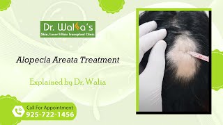 Alopecia Areata Treatment I How To Stop Alopecia Areata From Spreading [upl. by Ayatahs214]