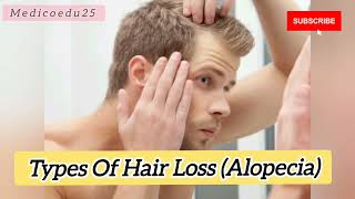 Types Of Alopecia Hair Loss   Stages Of Male Pattern Baldness बाल झड़ने के चरण [upl. by Wendelina]