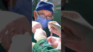 Facelift surgery before and after shorts plasticsurgery facelift beforeandafter turkey [upl. by Atkinson]