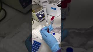 G6PD test procedure shorts youtubeshorts mls mlsd hemolysis [upl. by Dunstan]