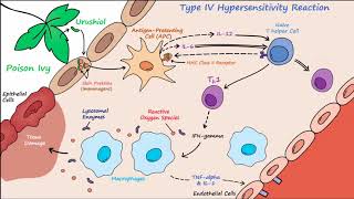 Type IV Hypersensitivity Described Concisely [upl. by Franky]