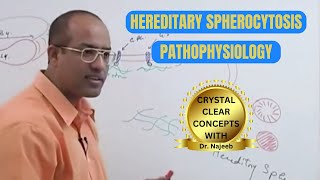 Hereditary Spherocytosis  Anemia  RBCs  Pathophysiology 🩺 [upl. by Anida]