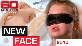 11year wait for woman whose face was ripped off by a gun  60 Minutes Australia [upl. by Laurance]