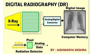 DIGITAL RADIOGRAPHY DR PART1  BY AISHWARYA MISHRA [upl. by Heinrich600]