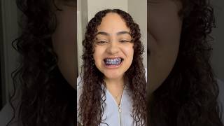 Does The Hismile Teeth Whitening Paste Really Work [upl. by Eidob]