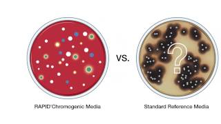 RAPIDChromogenic Media Solutions [upl. by Rugg]