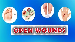 Types of Open Wounds Abrasion Laceration Skin Avulsion Puntured wounds [upl. by Fazeli]