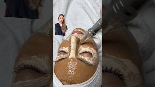 Watch Out BB Glow Facial Could Be Your Beauty Nightmare [upl. by Acinod157]