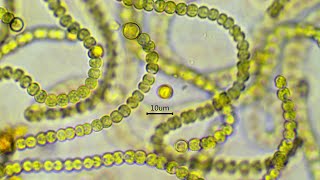 Nostoc commune  the nitrogen fixing cyanobacterium [upl. by Una]