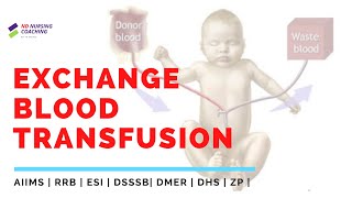 Exchange transfusion in newborn [upl. by Oakleil]