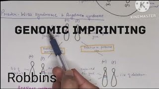 Genomic imprinting PraderWilli and Angelman syndrome Robbins हिंदी [upl. by Oak]