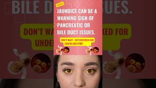 04  Pancreatic Disease Alert Jaundice Warning Signs What Yellow Skin amp Eyes Mean for Your Health [upl. by Erot]