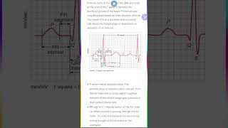 segments versus intervals in ECG طبيبالقلوبأحمدشبانة [upl. by Nairret]