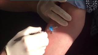 cannulation Technique in ACF [upl. by Erdnuaed]