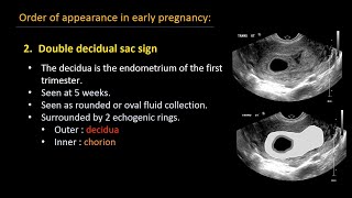 Ultrasound of normal early pregnancy [upl. by Nodlew]