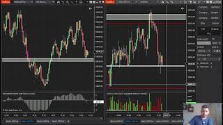 Live Trading STOP 250usd MNQ 9 de Septiembre 2024 [upl. by Christin473]