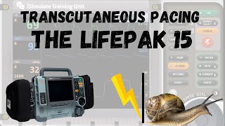 Quick Review LIFEPAK 15 PACING [upl. by Shem]