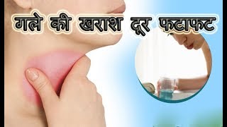 गले की खराश दूर करने के ज़बर्दस्त चमत्कारी घरेलु उपाय  Gale Ki Kharash Ka Ramban Ilaj  Sore Throat [upl. by Kwabena809]