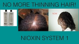 Nioxin Shampoo  Condition For Thinning Hair [upl. by Hardej201]