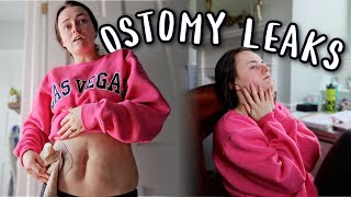 Im Over These Leaks So Im Ordering Different Ostomy Supplies  Lets Talk IBD [upl. by Jermaine]