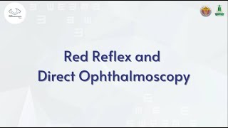 Red Reflex and Direct Ophthalmoscope [upl. by Sanjiv]