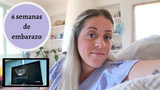 6 SEMANAS DE EMBARAZO 🤰 PRIMERA VISITA y PRIMERA ECOGRAFÍA 🧑🏼‍⚕️ AL BEBÉ YA LE LATE EL CORAZÓN ❤️🐣 [upl. by Eniron]