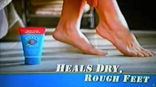 Gold Bond Foot Cream Commercial Victory Over De Feet [upl. by Leoline]