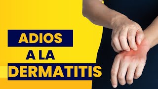 como curar la dermatitis en las manos  remedios caseros para la dermatitis en las manos [upl. by Isa541]