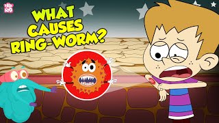 What Causes Ringworms  Skin Infection  The Dr Binocs Show  Peekaboo Kidz [upl. by Liakim420]