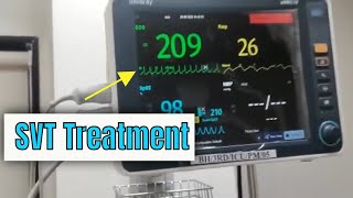 Adenosine in Supraventricular tachycardia SVT How to administer and how it works [upl. by Mikol]