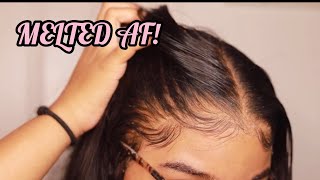 How to RE Install Frontal Wigs for Beginners  VERY DETAILED  Melt Transparent Lace [upl. by Ylahtan626]