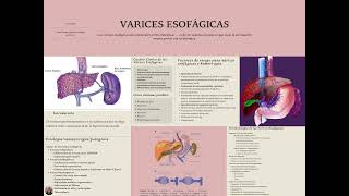 VARICES ESOFÁGICAS [upl. by Bobbee475]