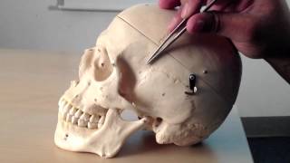 Skull Anatomy 1 of 5 Superior Posterior and Lateral Views  Head and Neck Anatomy 101 [upl. by Leakcim119]