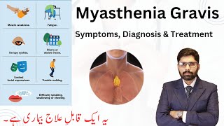 Myasthenia Gravis  Symptoms Causes Diagnosis Surgical Solutions in UrduHindi  Dr Ahmad Ali [upl. by Beilul]