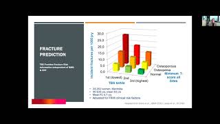 Webinar Integrating TBS into your Clinical DXA Practice International Scientific Symposium [upl. by Nemraciram]