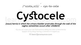 Cystocele pronunciation and definition [upl. by Selwin]