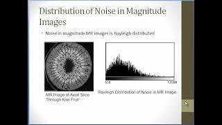 MRI Basics Course Module 10 Topic 1 Signal Contrast and Noise [upl. by Arlyne]